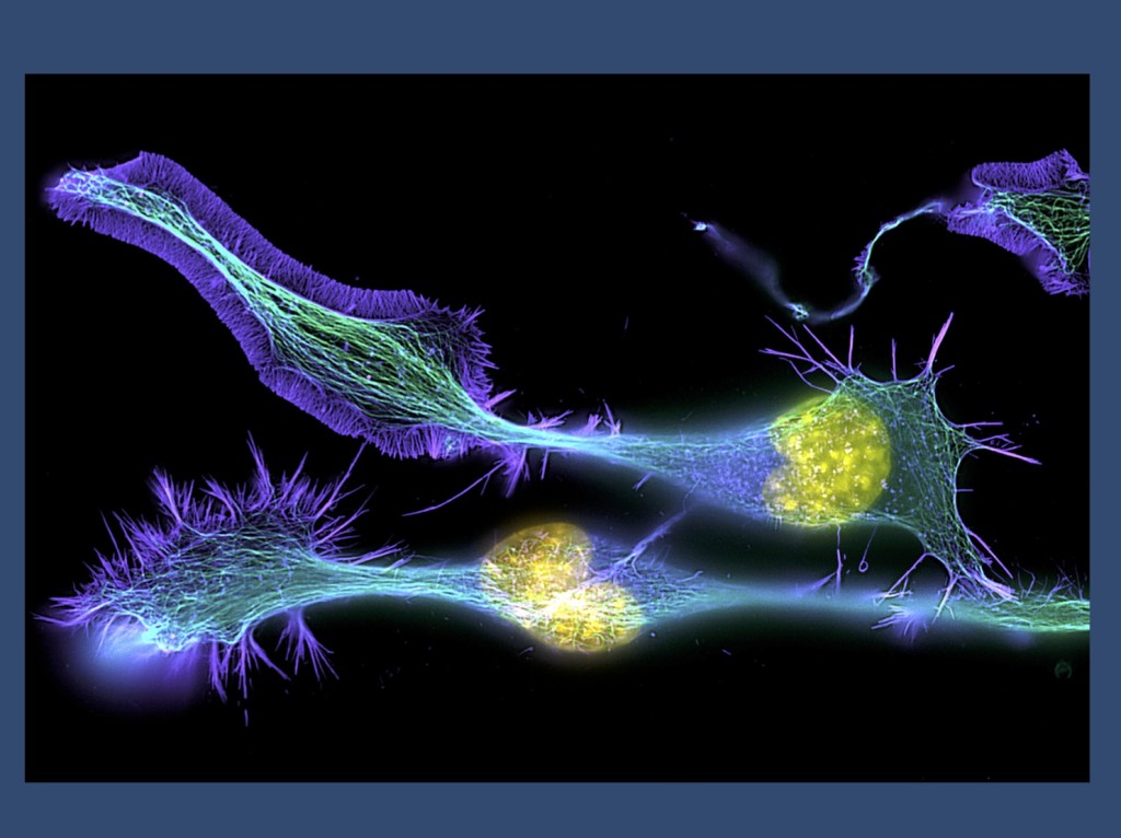Developing neurons (from https://www.flickr.com/photos/zeissmicro/14256058429 under a Creative Commons License)