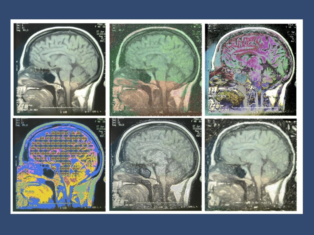 Exome sequencing is just like a genetic MRI scan? (Image adapted from https://www.flickr.com/photos/piper/22584430 under a Creative Commons Licence)