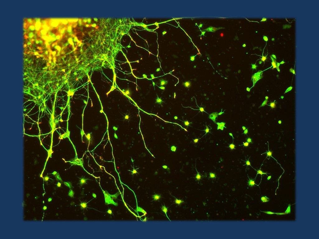 Edinger-Westphal neurons in culture. Stained for Tubulin (green) and Synapsin (red). Imaged with a Zeiss Axioskop 2 FS Plus equipped with a Zeiss Axiocam HRm. 100x total magnification. Modified under a CC license from https://www.flickr.com/photos/thelunch_box/2798522576/ 